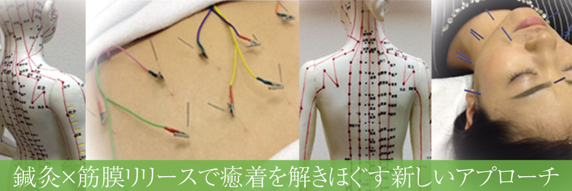 鍼灸院施術の様子