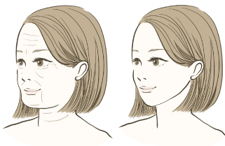顔のたるみ