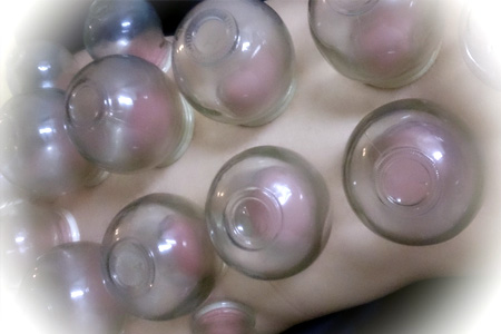 カッピングイメージ